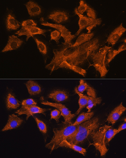AVPR1A Rabbit polyclonal antibody