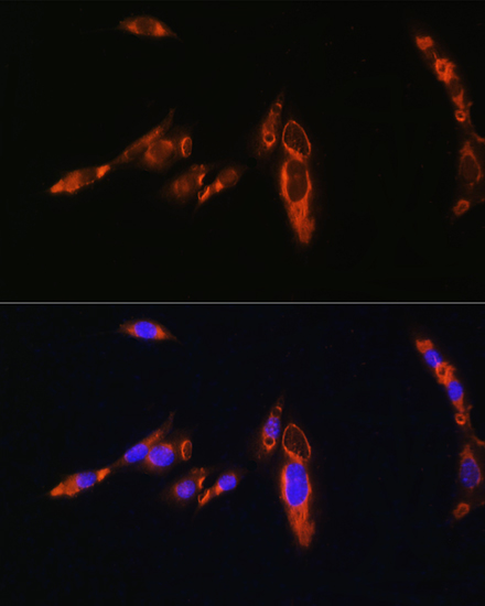 AVPR1A Rabbit polyclonal antibody