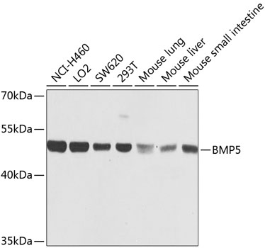 BMP5 Rabbit polyclonal antibody
