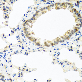 BMP5 Rabbit polyclonal antibody