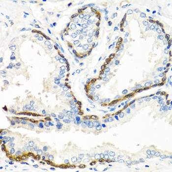 BMP5 Rabbit polyclonal antibody