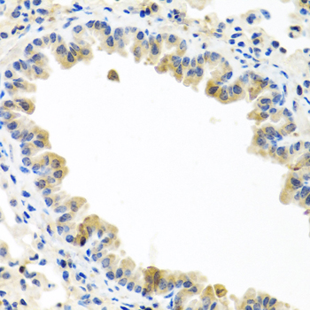 BMP5 Rabbit polyclonal antibody