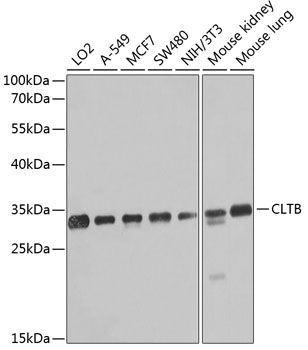 CLTB Rabbit polyclonal antibody