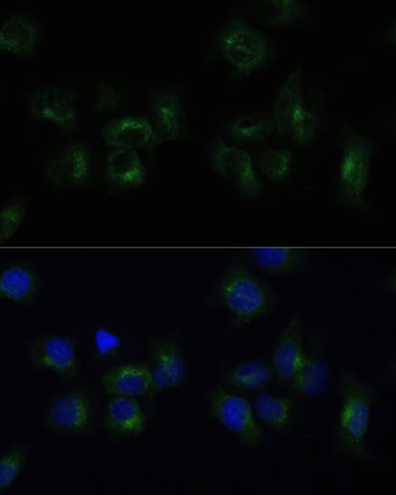 CLTB Rabbit polyclonal antibody