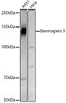 Western blot - Desmoglein 3 Rabbit pAb (A8412)