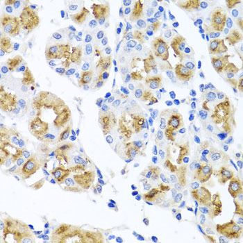 FECH Rabbit polyclonal antibody
