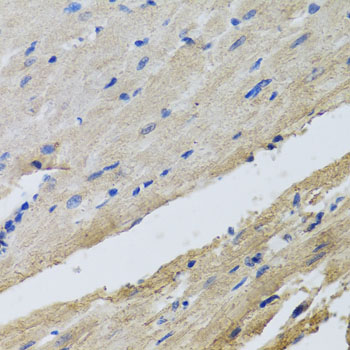 FECH Rabbit polyclonal antibody