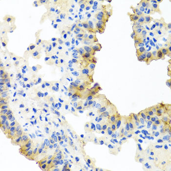 FECH Rabbit polyclonal antibody