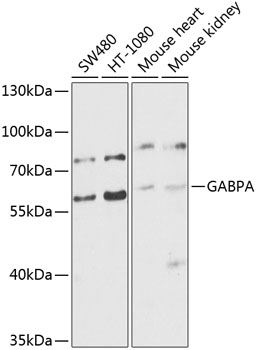 GABPA Rabbit polyclonal antibody