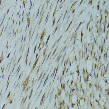 GABPA Rabbit polyclonal antibody
