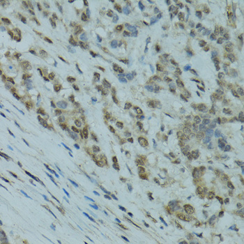 GABPA Rabbit polyclonal antibody