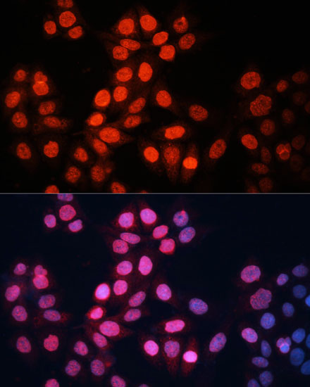 GABPA Rabbit polyclonal antibody