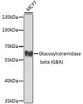 Western blot - Glucosylceramidase beta (GBA) Rabbit pAb (A8420)