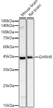 GHRHR Rabbit polyclonal antibody
