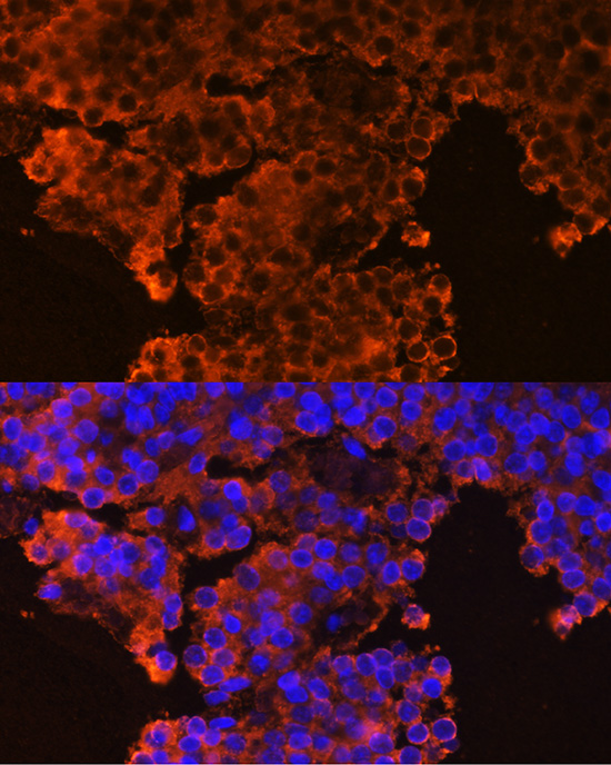 GHRHR Rabbit polyclonal antibody