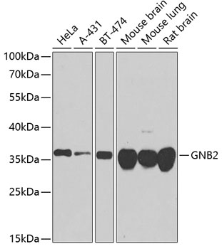 GNB2 Rabbit polyclonal antibody