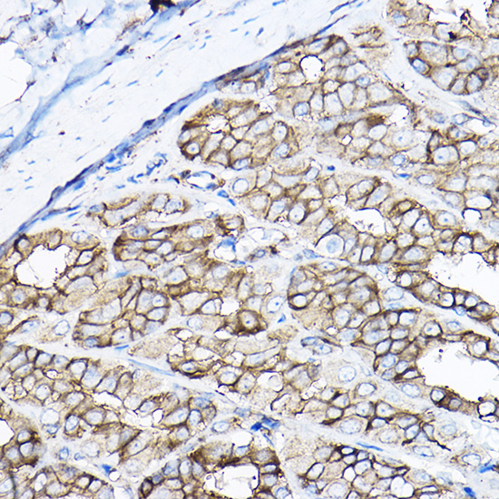 GNB2 Rabbit polyclonal antibody