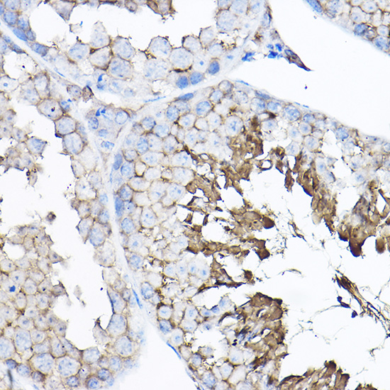 GNB2 Rabbit polyclonal antibody