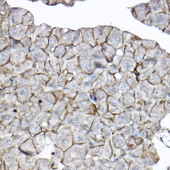 GNB2 Rabbit polyclonal antibody