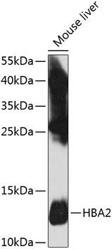 HBA2 Rabbit polyclonal antibody