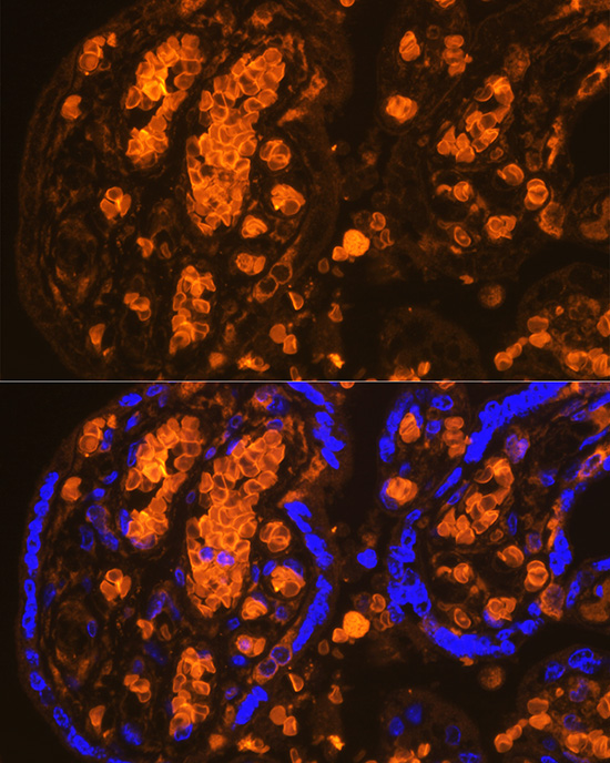 HBA2 Rabbit polyclonal antibody