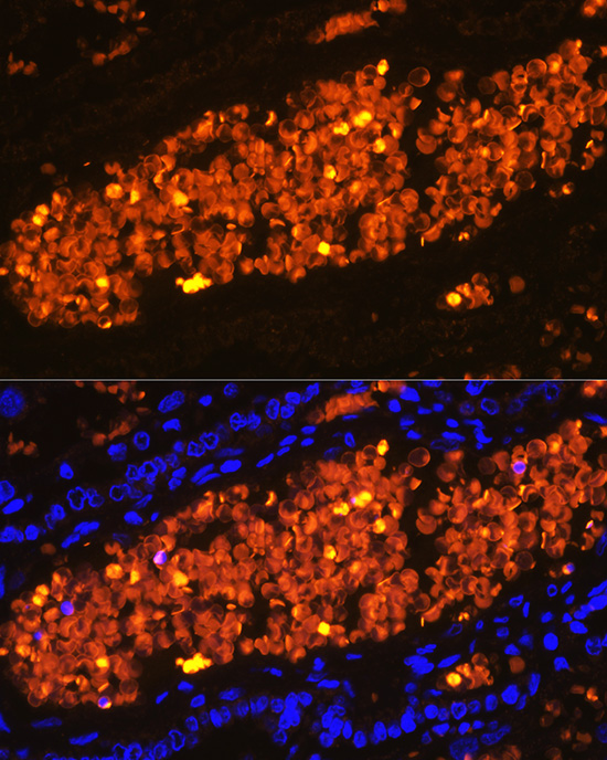 HBA2 Rabbit polyclonal antibody