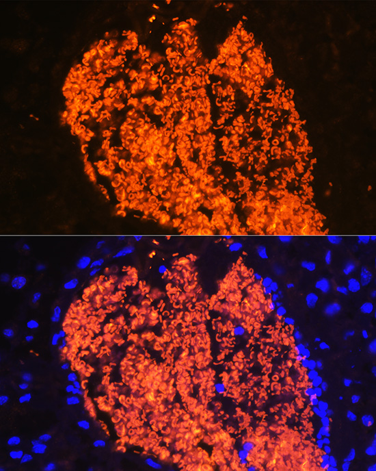 HBA2 Rabbit polyclonal antibody