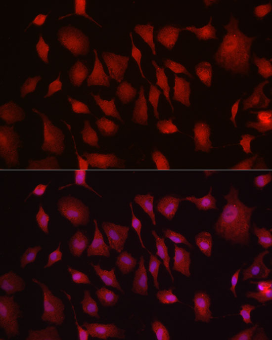 HK3 Rabbit polyclonal antibody