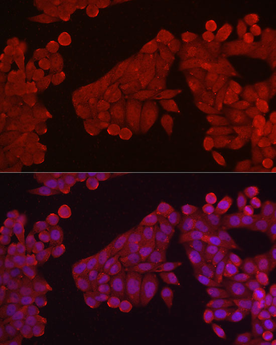 HK3 Rabbit polyclonal antibody