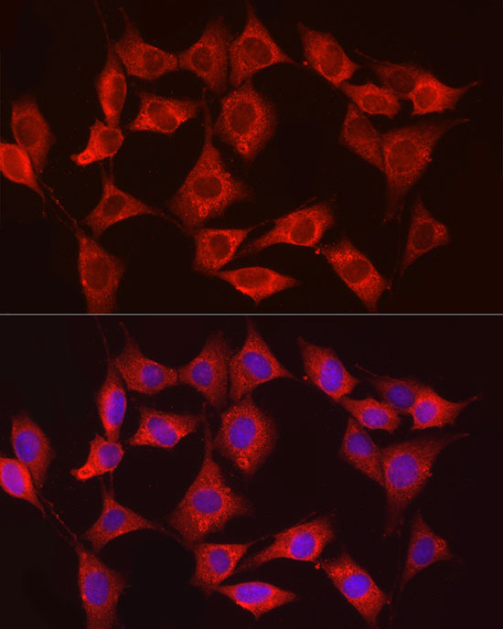 HK3 Rabbit polyclonal antibody