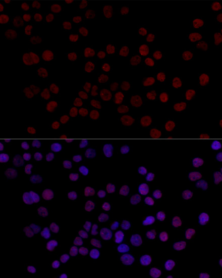 HNRNPL Rabbit polyclonal antibody