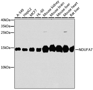 [KO Validated] NDUFA7 Rabbit polyclonal antibody
