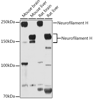Neurofilament H Rabbit polyclonal antibody