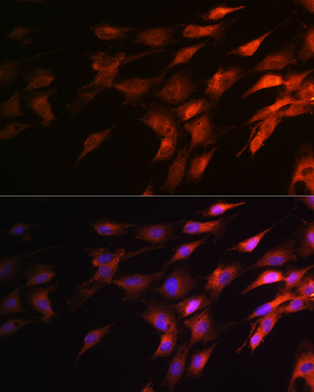 Neurofilament H Rabbit polyclonal antibody