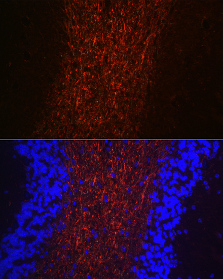 Neurofilament H Rabbit polyclonal antibody