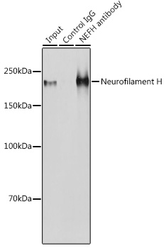 Neurofilament H Rabbit polyclonal antibody