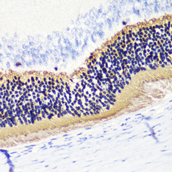 PDC Rabbit polyclonal antibody