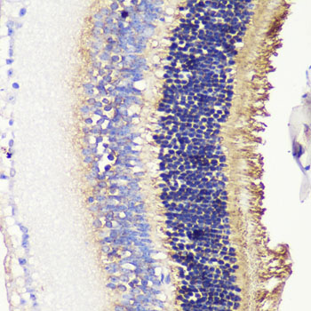 PDC Rabbit polyclonal antibody