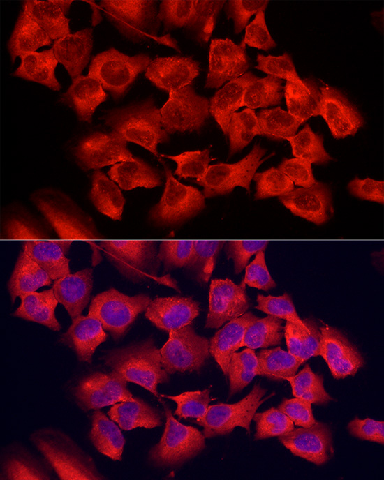 PER1 Rabbit polyclonal antibody