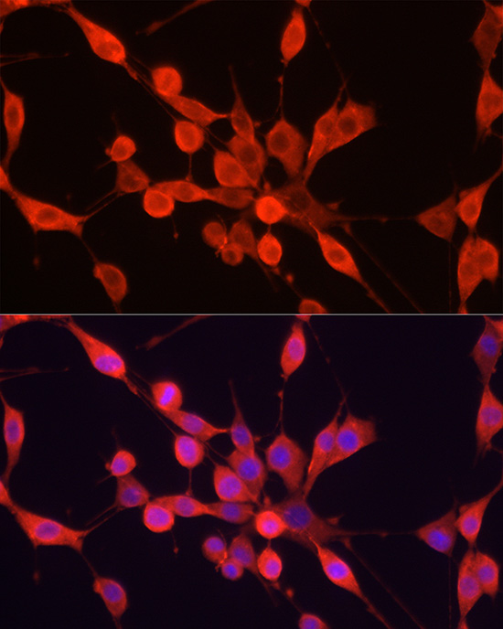 PER1 Rabbit polyclonal antibody