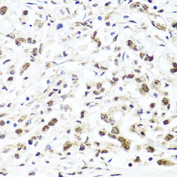 [KO Validated] HIRA Rabbit polyclonal antibody