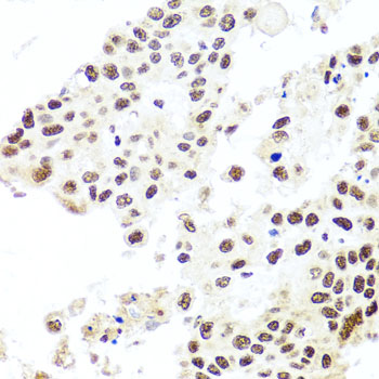 [KO Validated] HIRA Rabbit polyclonal antibody