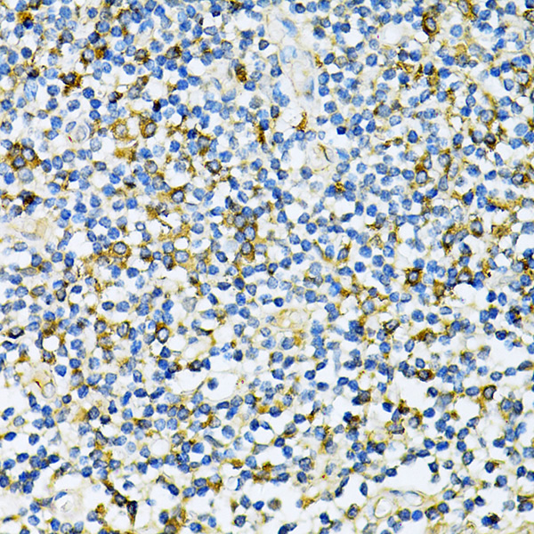 UVRAG Rabbit polyclonal antibody