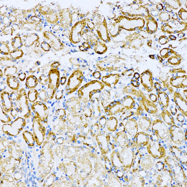 UVRAG Rabbit polyclonal antibody