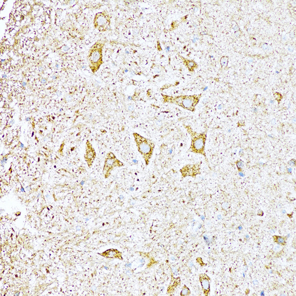 UVRAG Rabbit polyclonal antibody