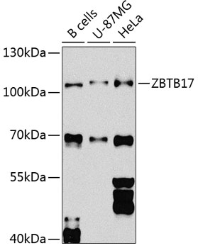 ZBTB17 Rabbit polyclonal antibody