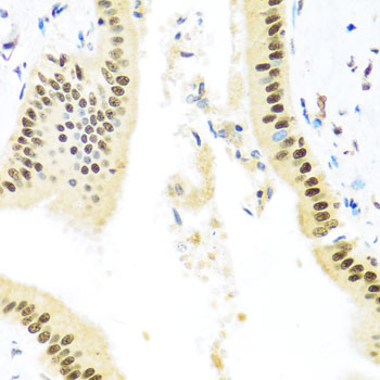 ZBTB17 Rabbit polyclonal antibody