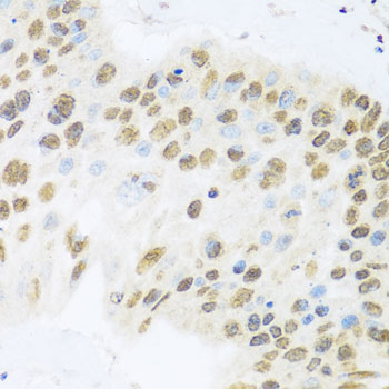 ZBTB17 Rabbit polyclonal antibody