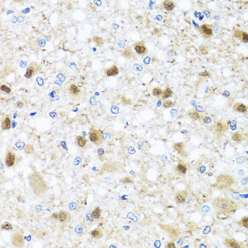 ZBTB17 Rabbit polyclonal antibody
