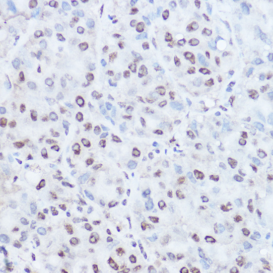 TAF15 Rabbit polyclonal antibody